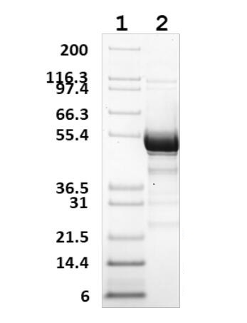 Lane 1: Molecular weight marker (Mark12 Unstained Standard)<br />Lane 2: RTRXR1